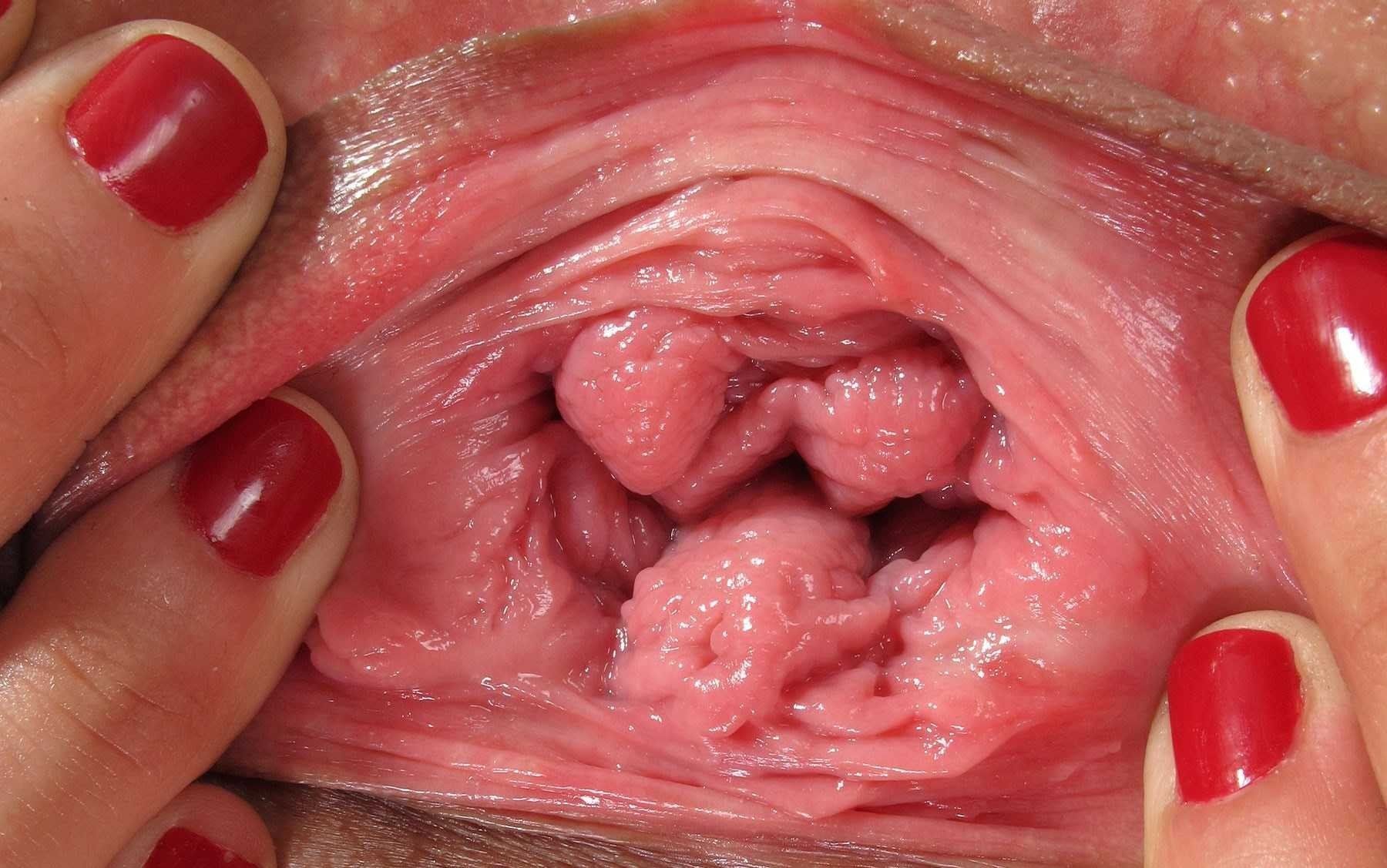 Fits whole head inside vagina